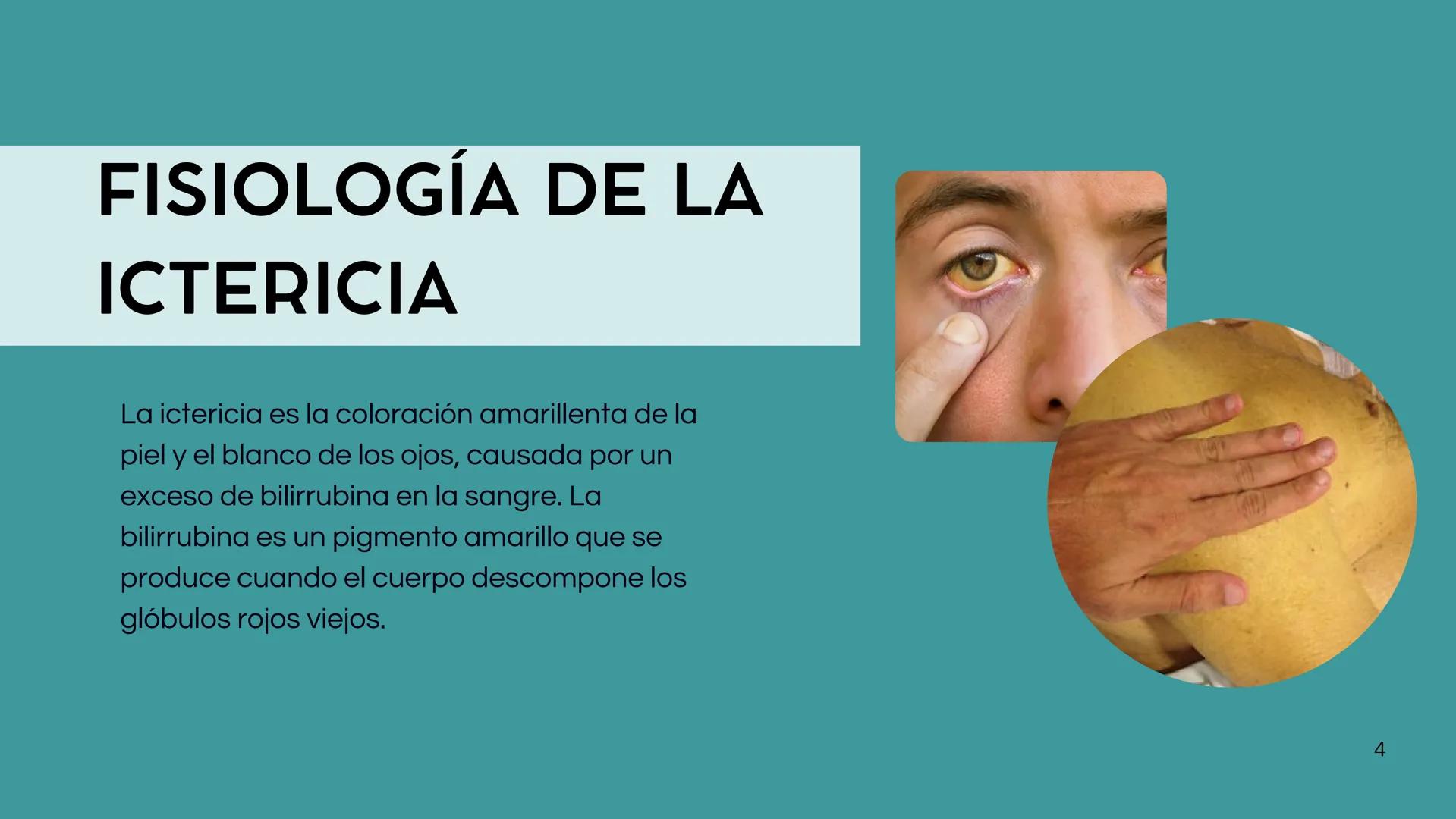 • Colesterol
• Electrolitos y
agua
• Sales Biliares
• Bilirrubina
• Fosfolipidos
FORMACIÓN DE LA
BILIS
Canal biliar
Arteria
Vena
Canaliculos