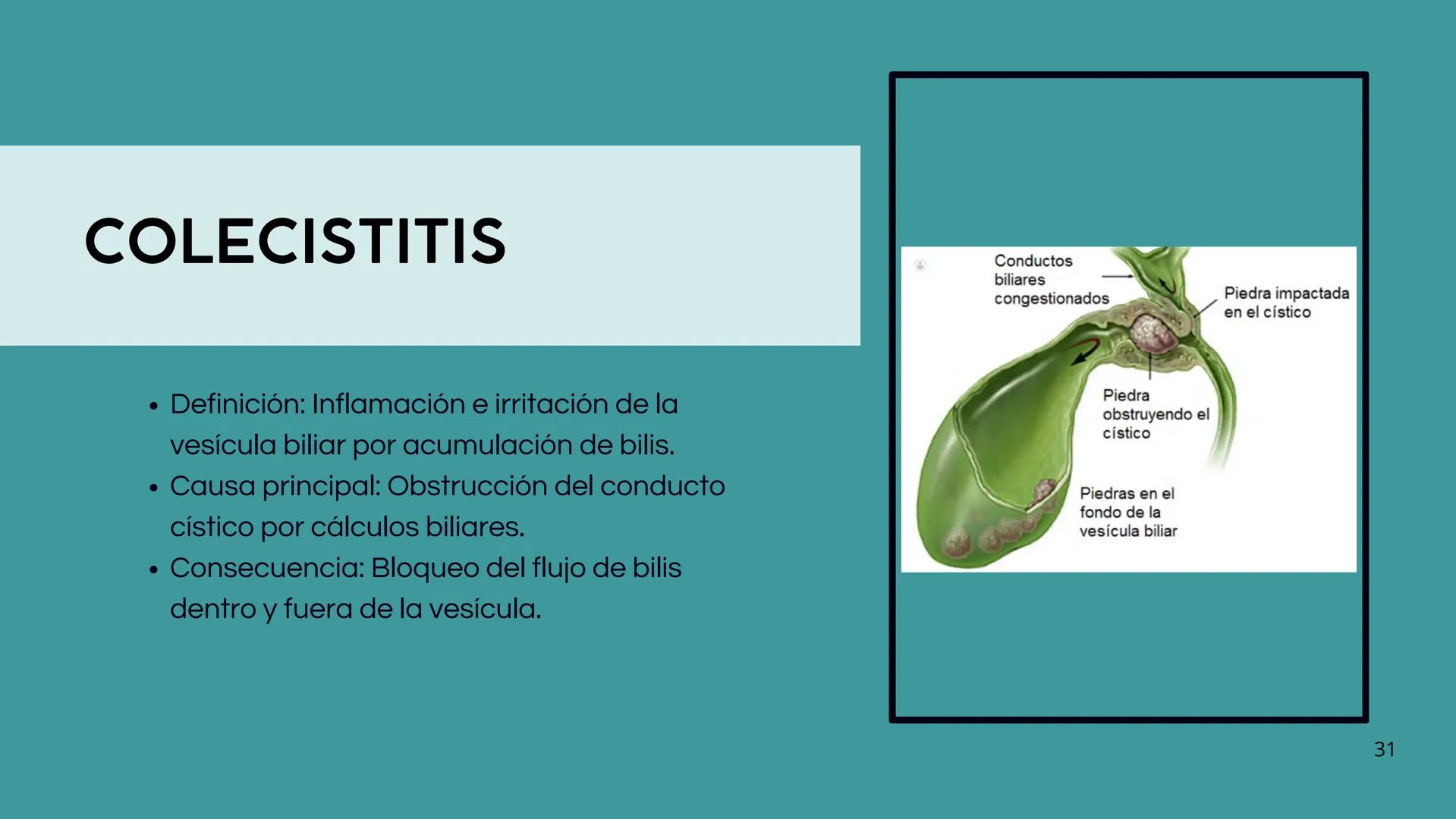 • Colesterol
• Electrolitos y
agua
• Sales Biliares
• Bilirrubina
• Fosfolipidos
FORMACIÓN DE LA
BILIS
Canal biliar
Arteria
Vena
Canaliculos