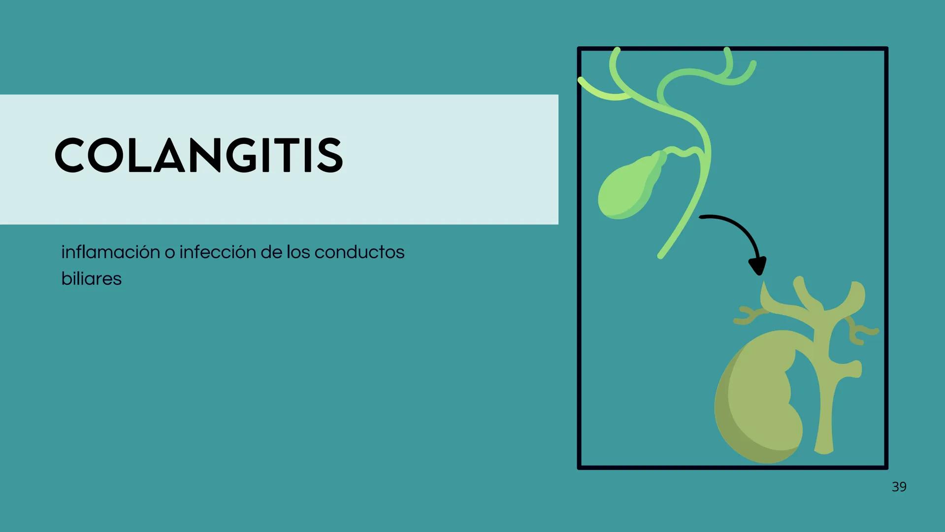 • Colesterol
• Electrolitos y
agua
• Sales Biliares
• Bilirrubina
• Fosfolipidos
FORMACIÓN DE LA
BILIS
Canal biliar
Arteria
Vena
Canaliculos