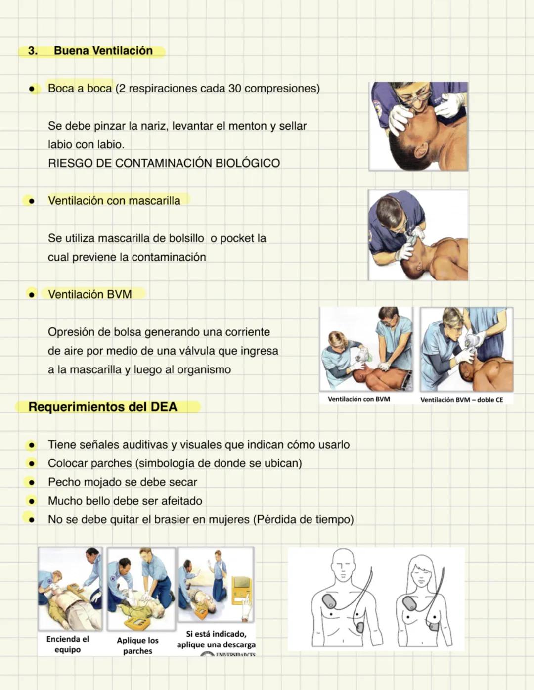 Atención Inicial al Paciente
Reanimación cerebro cardiopulmonar en el paciente adulto y pediatrico
Paro cardiaco: Interrupción súbita de la