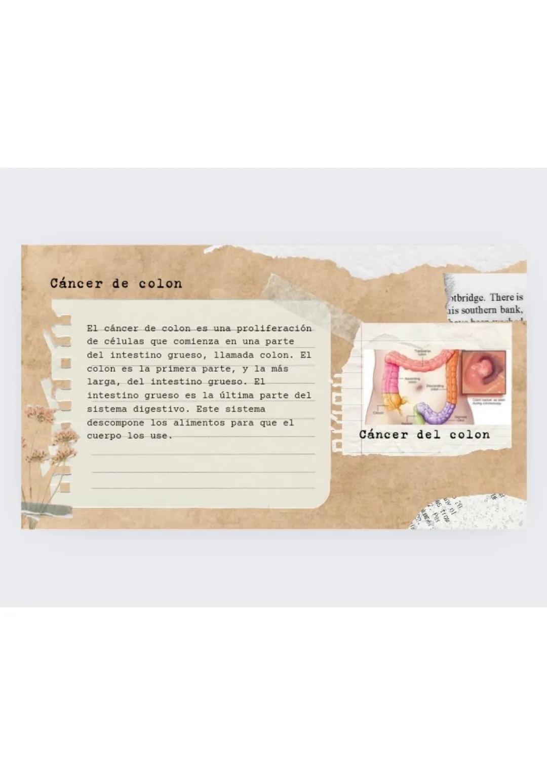 ASSIGNMENT DR. BY
UNIT
CH. BY
Cáncer
hereditario
Nombre:
Genetica
Grado: 9
1k.
vay
Ley Longvilie
car park (Gl
th map, "GP
ome of these an
he