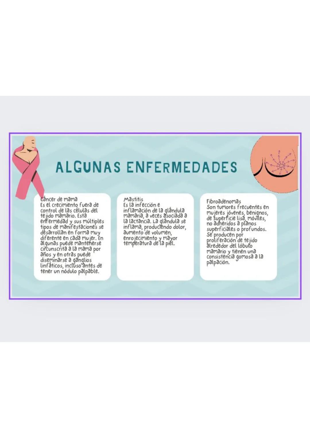 # GLANDULAS
MAMARIAS
GRADO : 8 DEFINICION
órgano glandular ubicado en el pecho.
La glándula mamaria está formada por
tejido conjuntivo, g