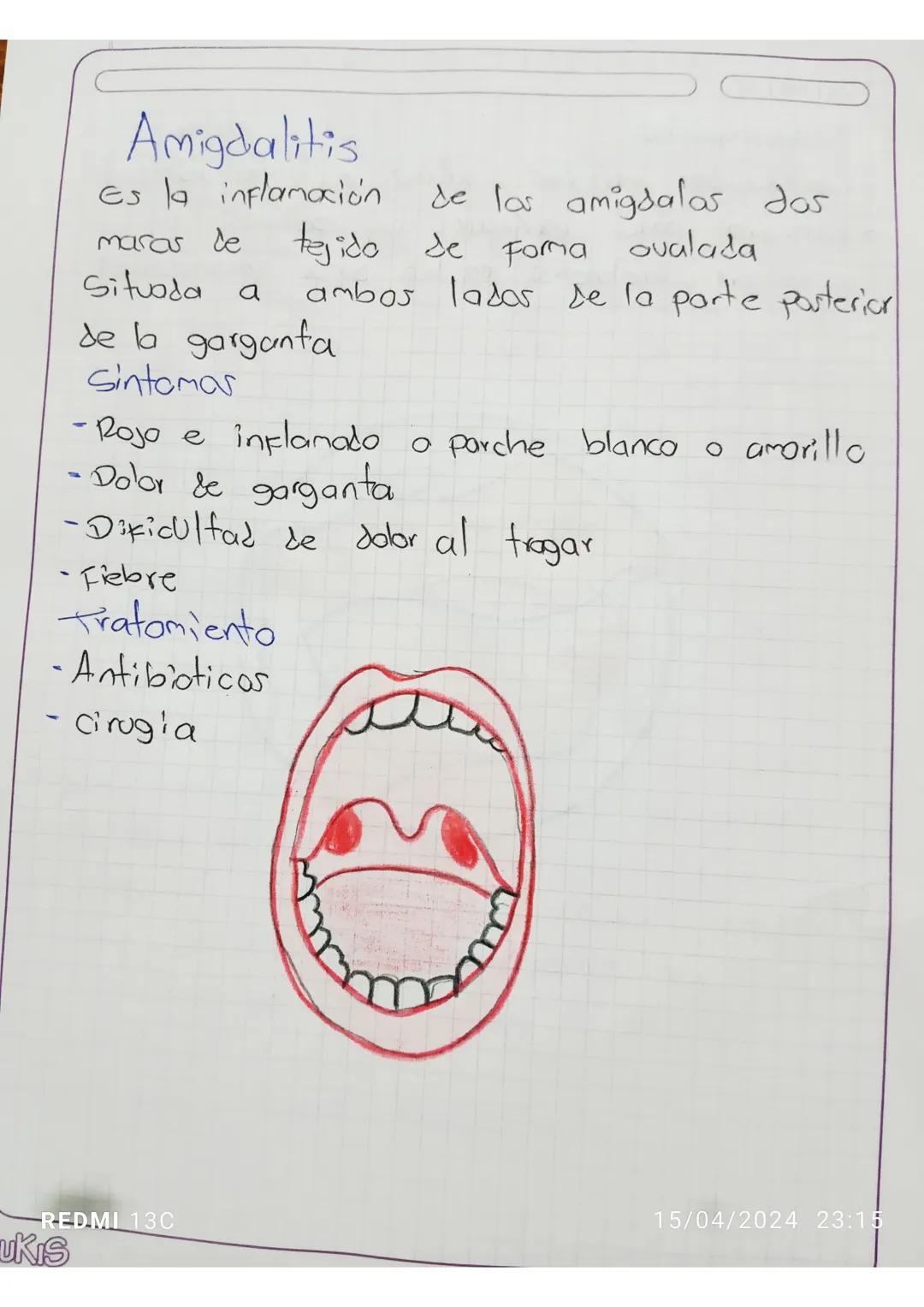 TAILER
Glaucoma Es una
enfermedad
que daña
el nervio óptico del
ojo.
Generalmente
se
Produce cuando
50
acumula
Fluido
en la
Parte
delantera