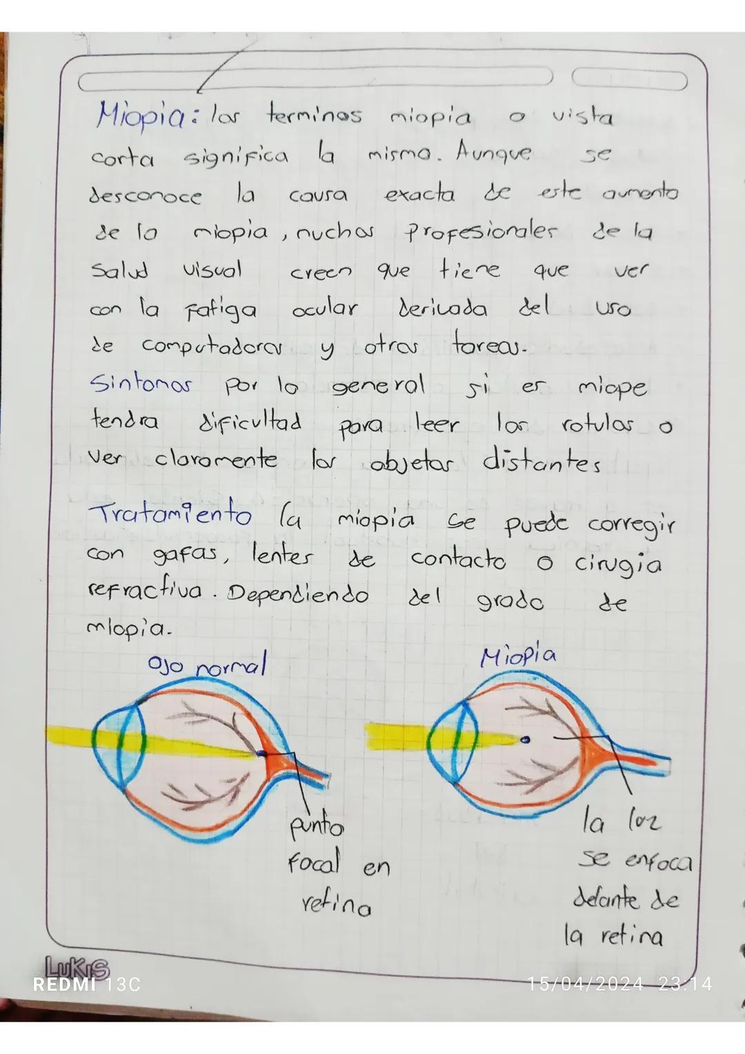 TAILER
Glaucoma Es una
enfermedad
que daña
el nervio óptico del
ojo.
Generalmente
se
Produce cuando
50
acumula
Fluido
en la
Parte
delantera