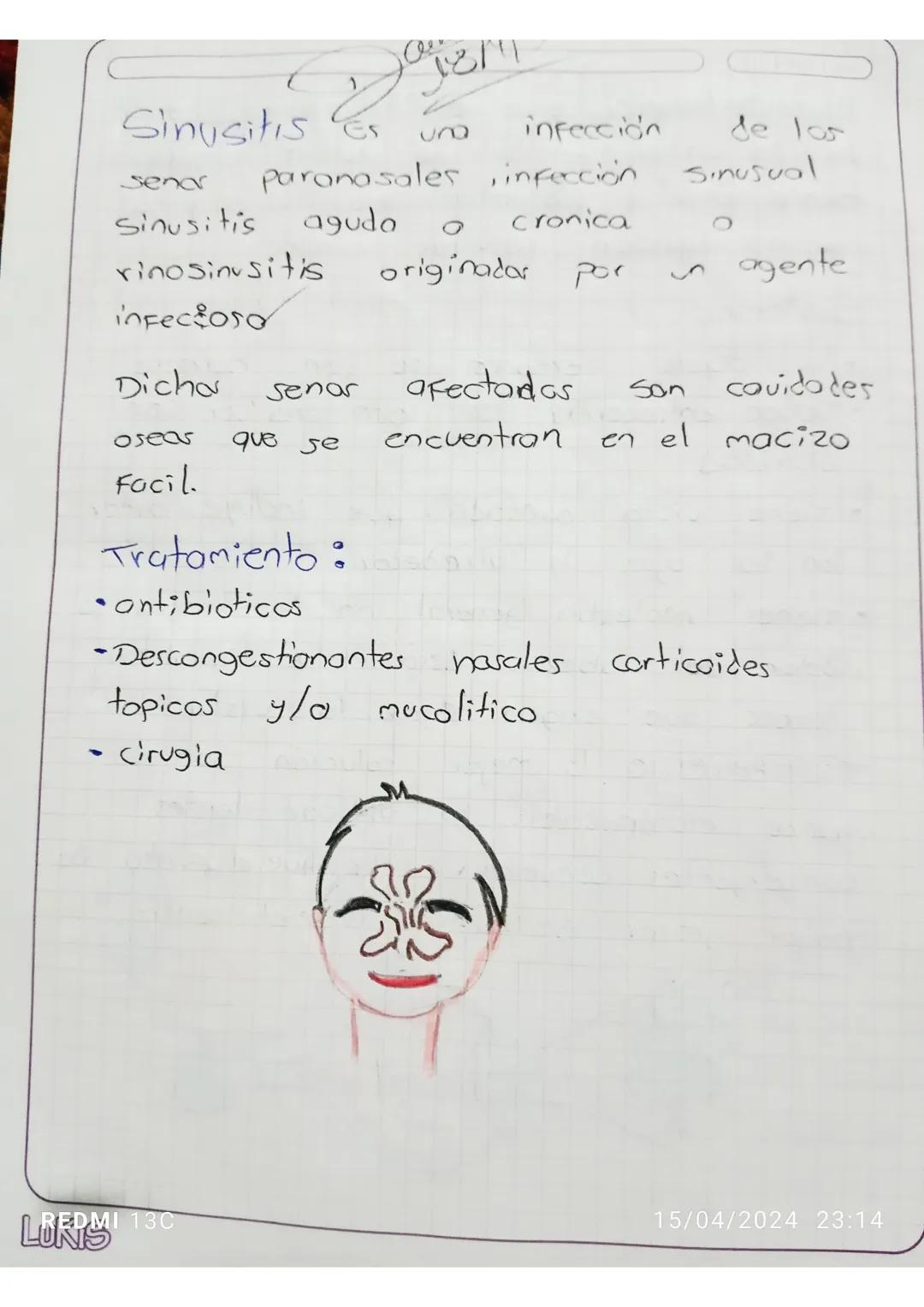 TAILER
Glaucoma Es una
enfermedad
que daña
el nervio óptico del
ojo.
Generalmente
se
Produce cuando
50
acumula
Fluido
en la
Parte
delantera