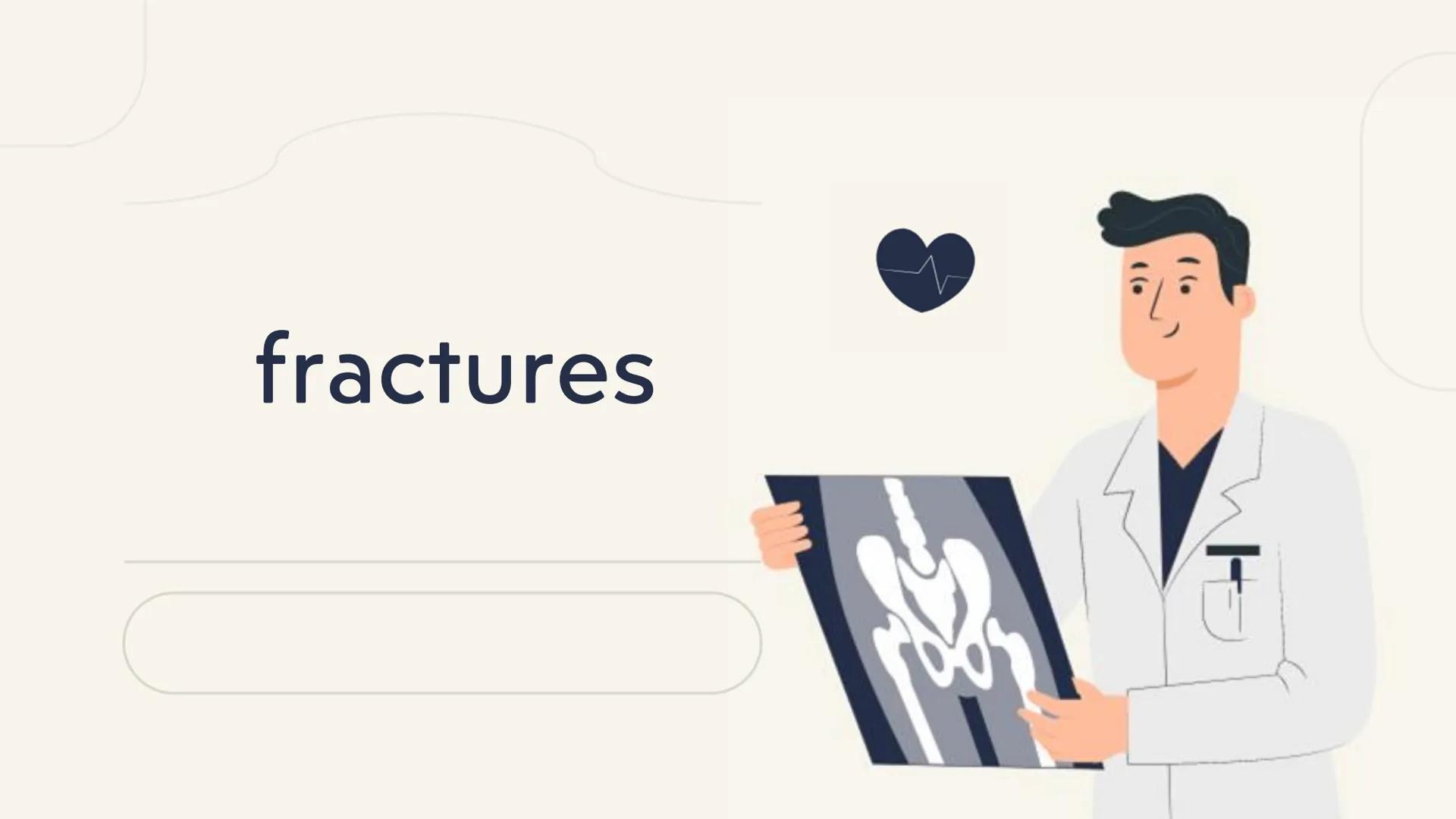 # fractures # What is a fracture?
It is the total or partial rupture of a bone for various reasons; the most common
is that it is due to an