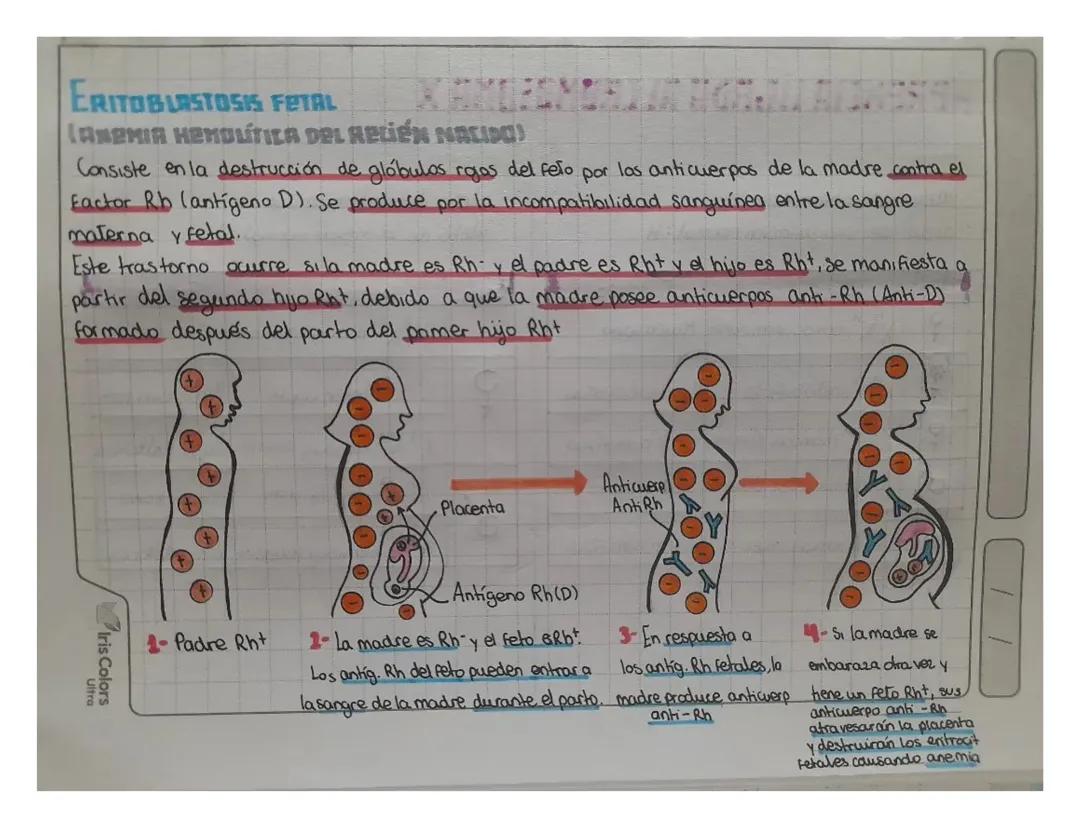Eritoblastosis Fetal