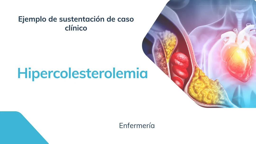 Ejemplo presentación caso hipercolesterolemia.