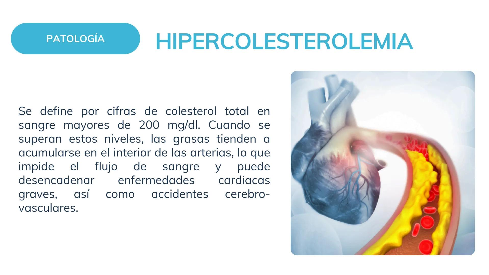 # Ejemplo de sustentación de caso clínico
# Hipercolesterolemia
Enfermería SISTEMA
COMPROMETIDO
SISTEMA CARDIOVASCULAR
El sistema cardiova